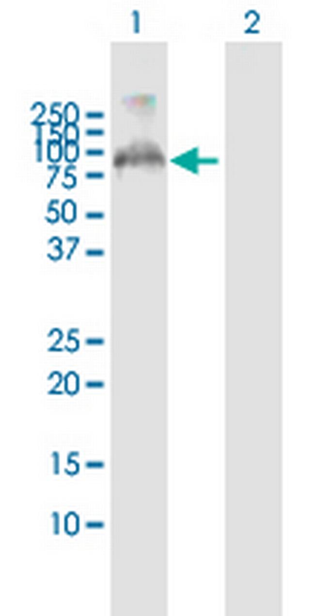 FBXO7 Antibody in Western Blot (WB)