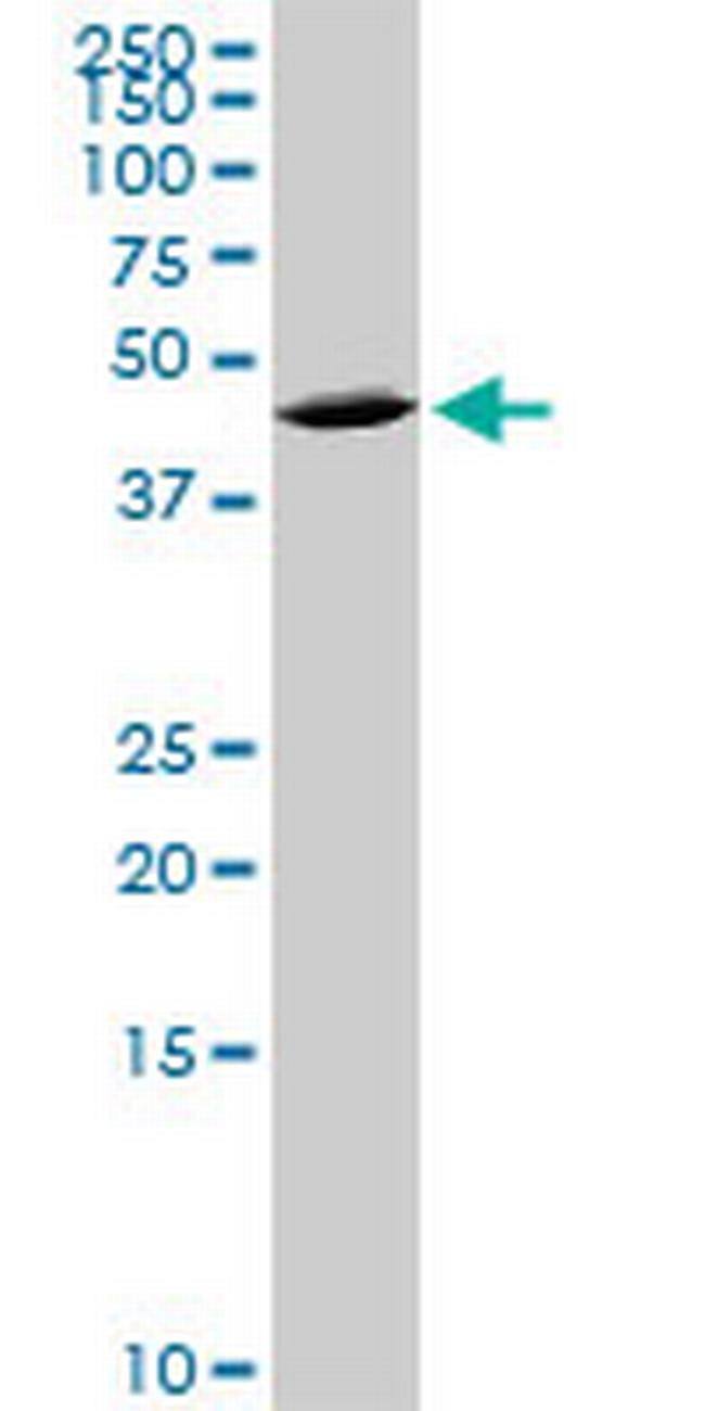 QPCT Antibody in Western Blot (WB)