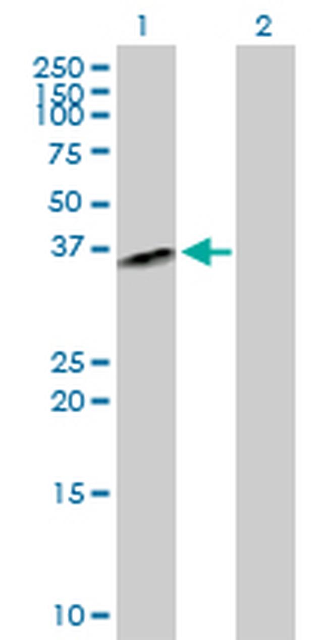 QPCT Antibody in Western Blot (WB)