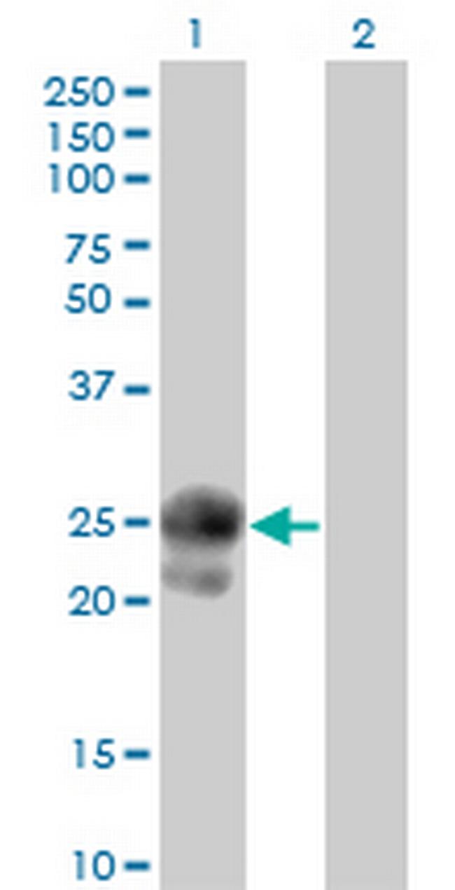 BAMBI Antibody in Western Blot (WB)