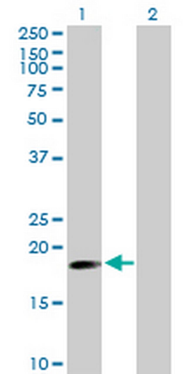 TNFAIP8 Antibody in Western Blot (WB)