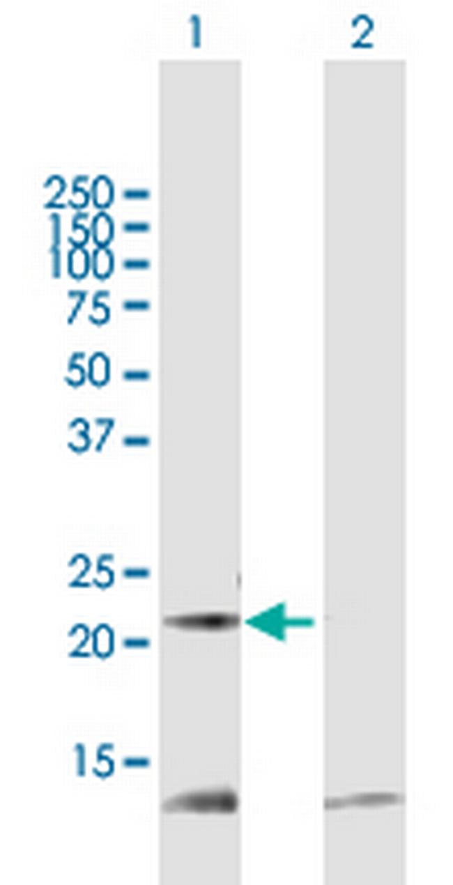 PRDX5 Antibody in Western Blot (WB)