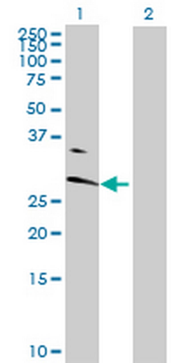 ABHD14A Antibody in Western Blot (WB)