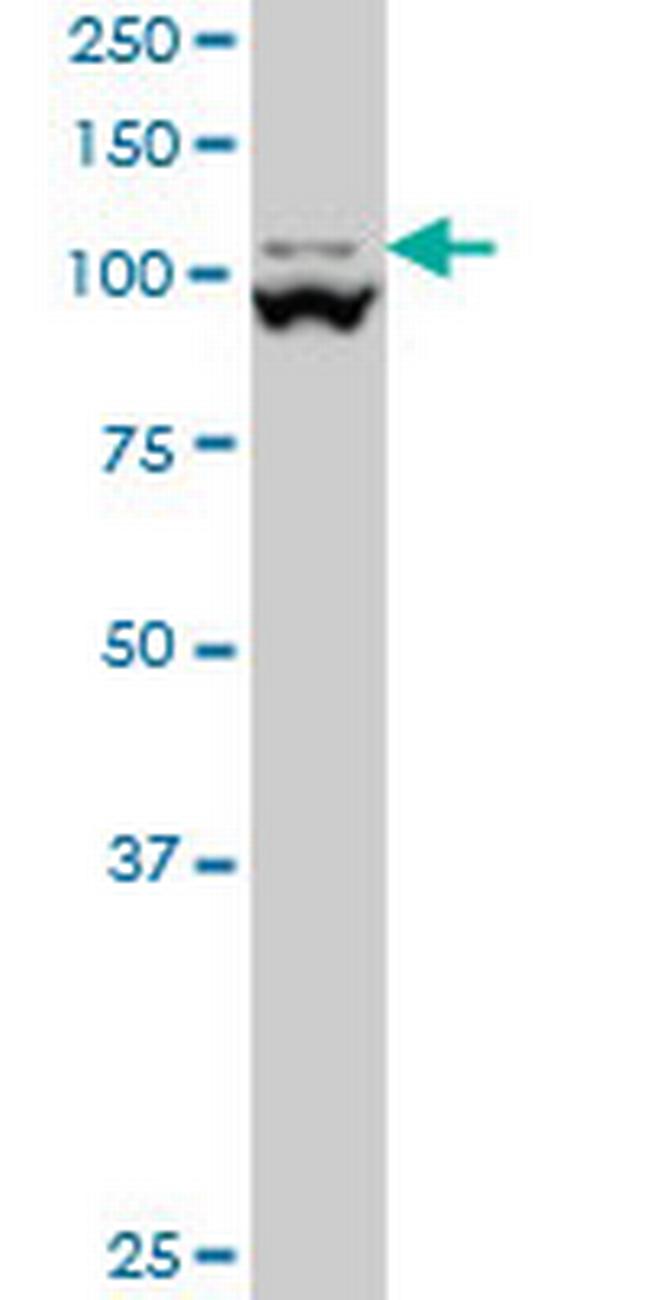 MTHFD1L Antibody in Western Blot (WB)