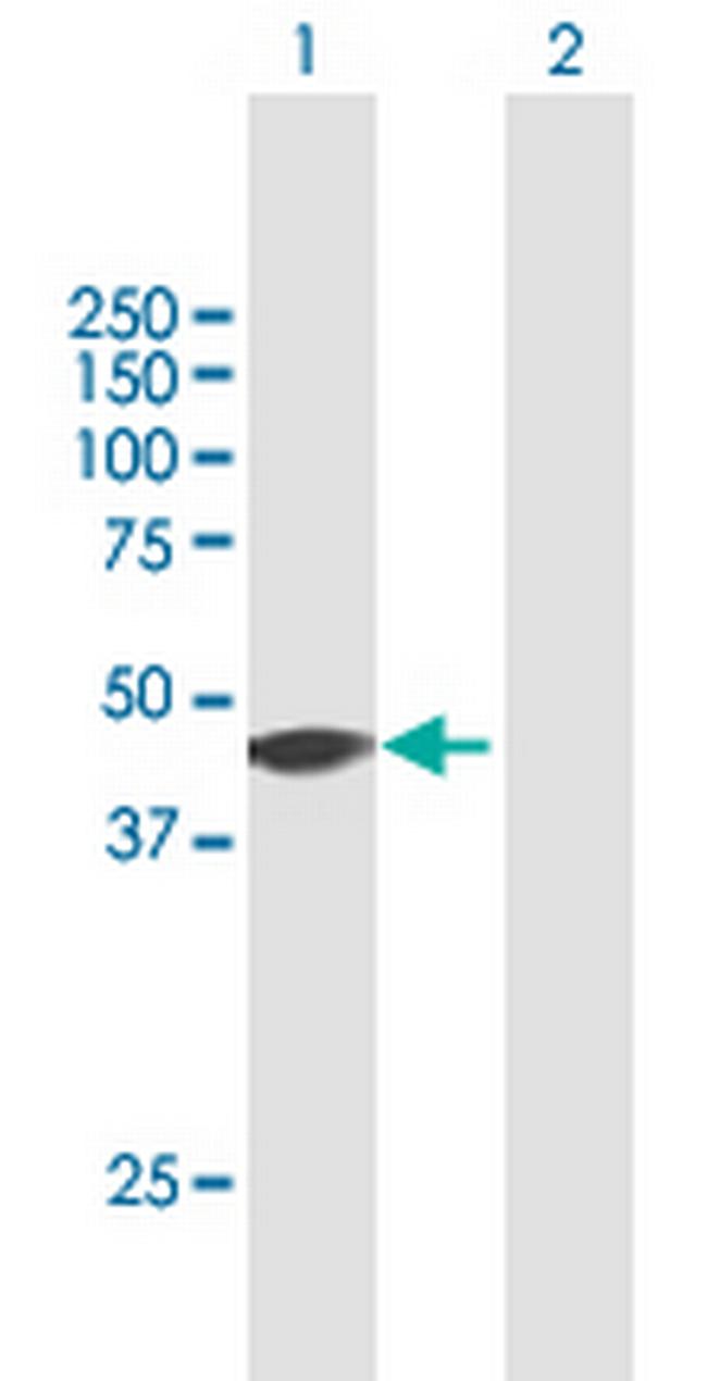 ZNF385 Antibody in Western Blot (WB)