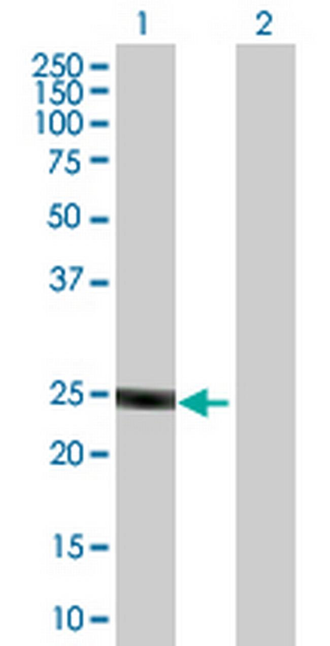 ULK3 Antibody in Western Blot (WB)