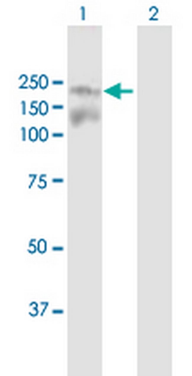 IBTK Antibody in Western Blot (WB)