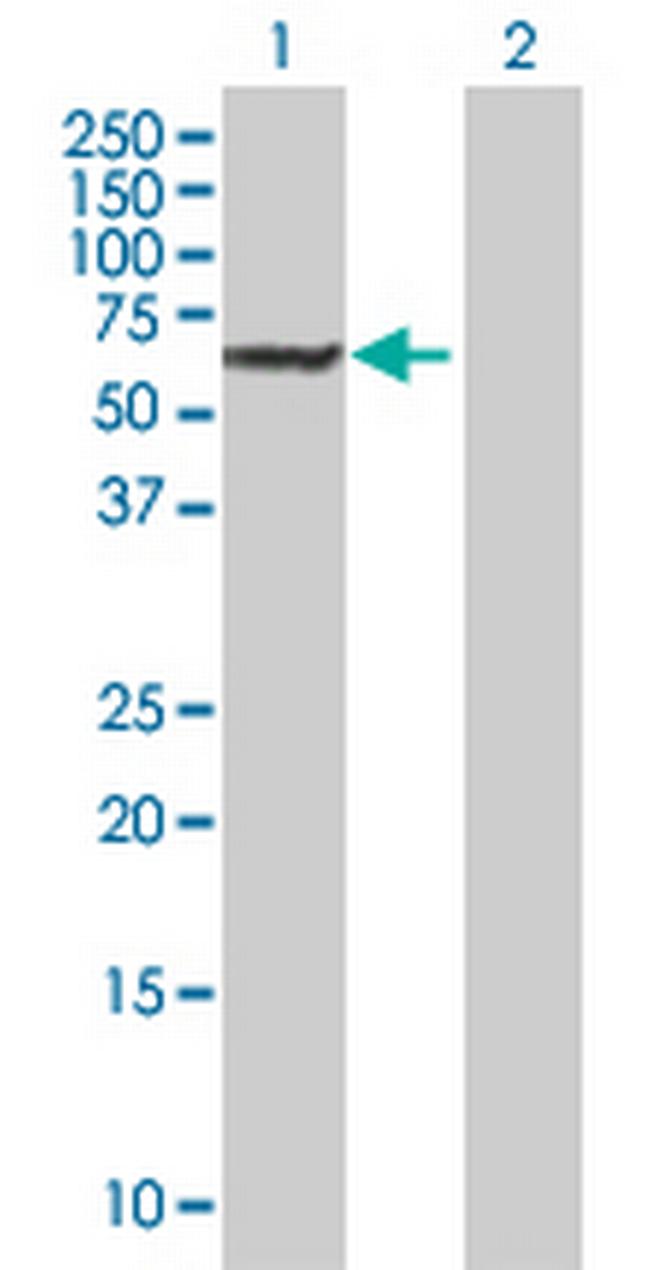 DAK Antibody in Western Blot (WB)