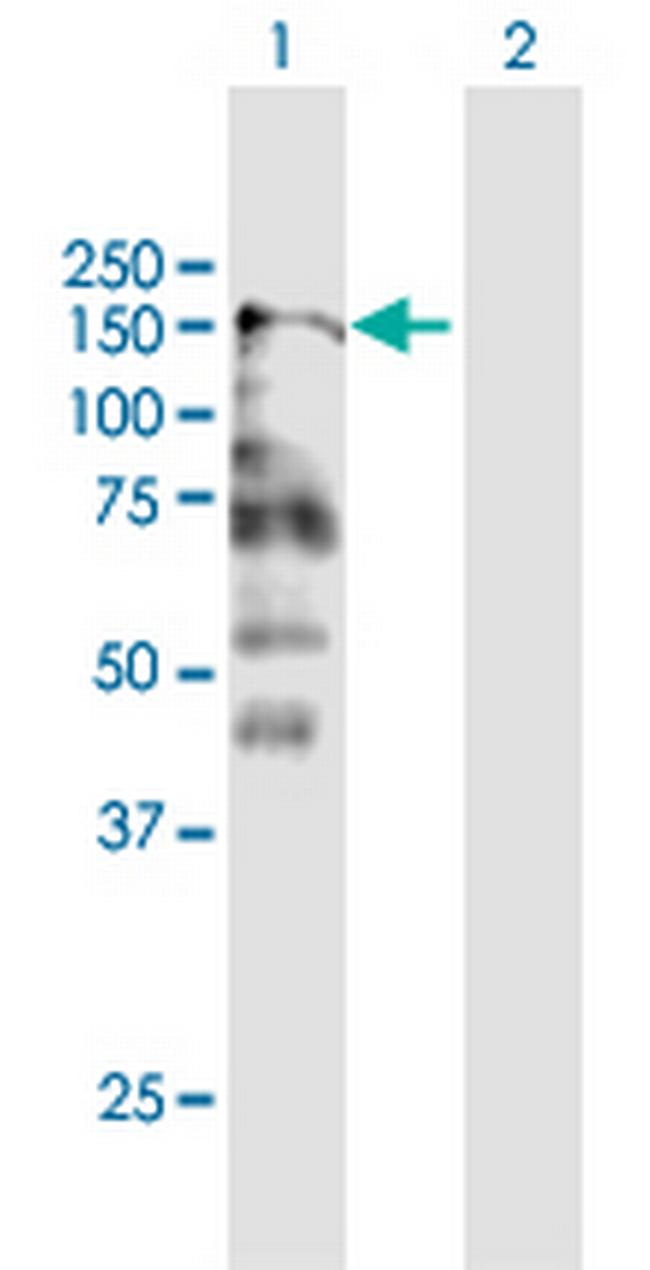 CNTNAP2 Antibody in Western Blot (WB)