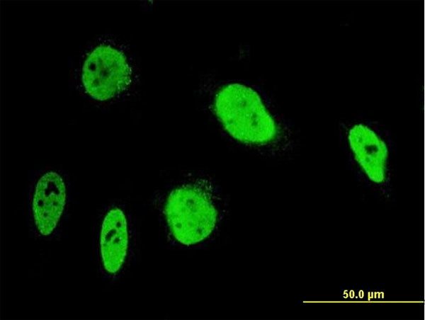 ANKRD17 Antibody in Immunocytochemistry (ICC/IF)