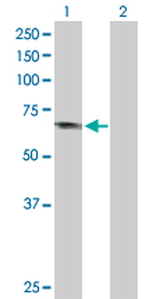 APPL1 Antibody in Western Blot (WB)