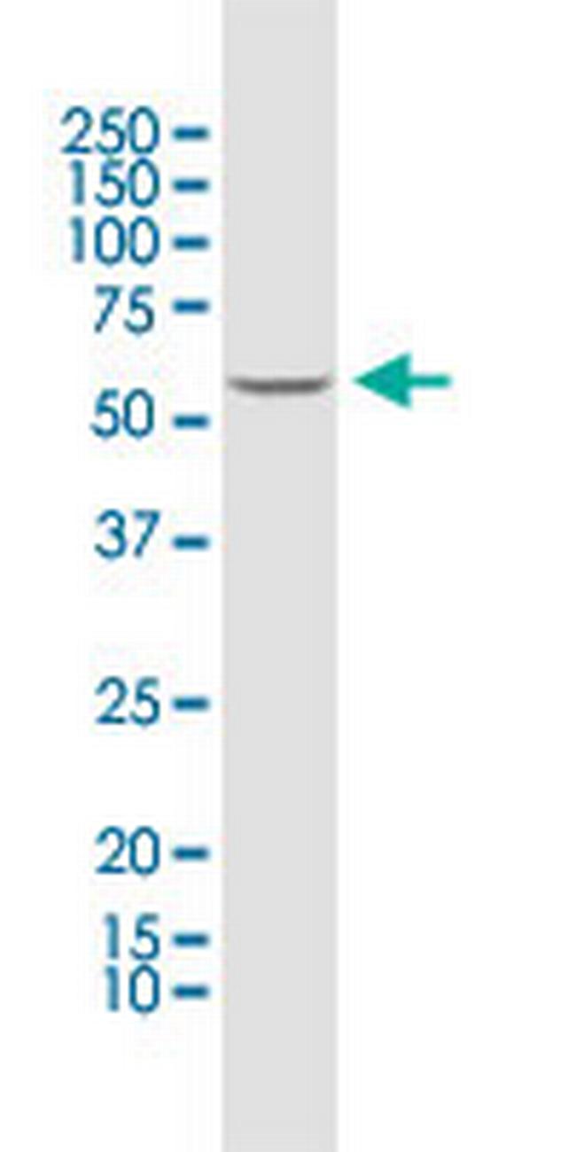PRPF31 Antibody in Western Blot (WB)