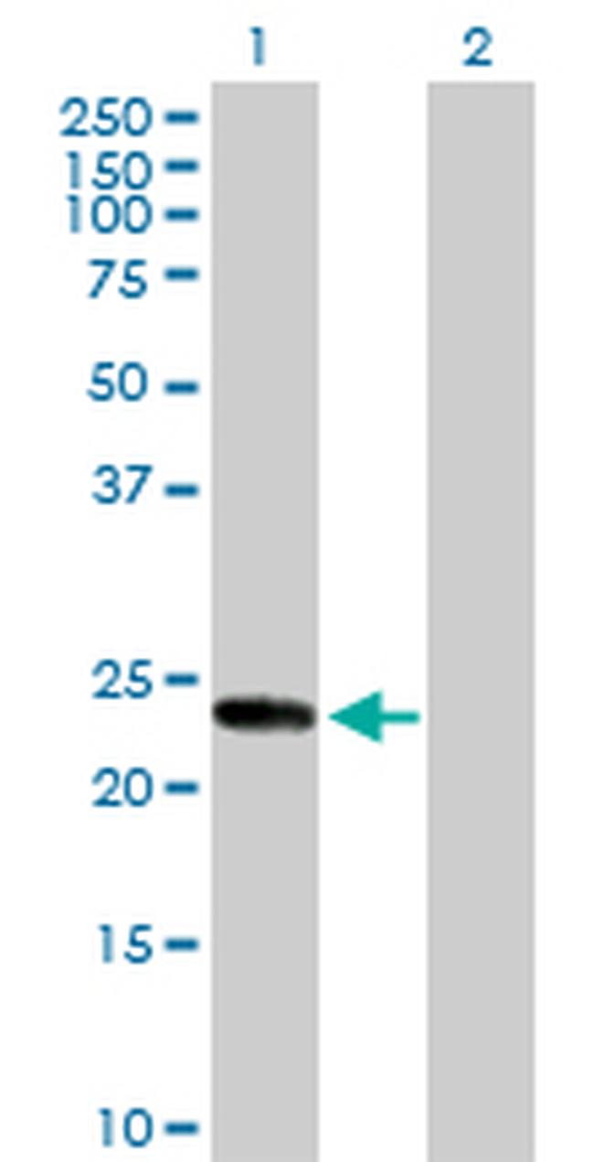 KIF26A Antibody in Western Blot (WB)