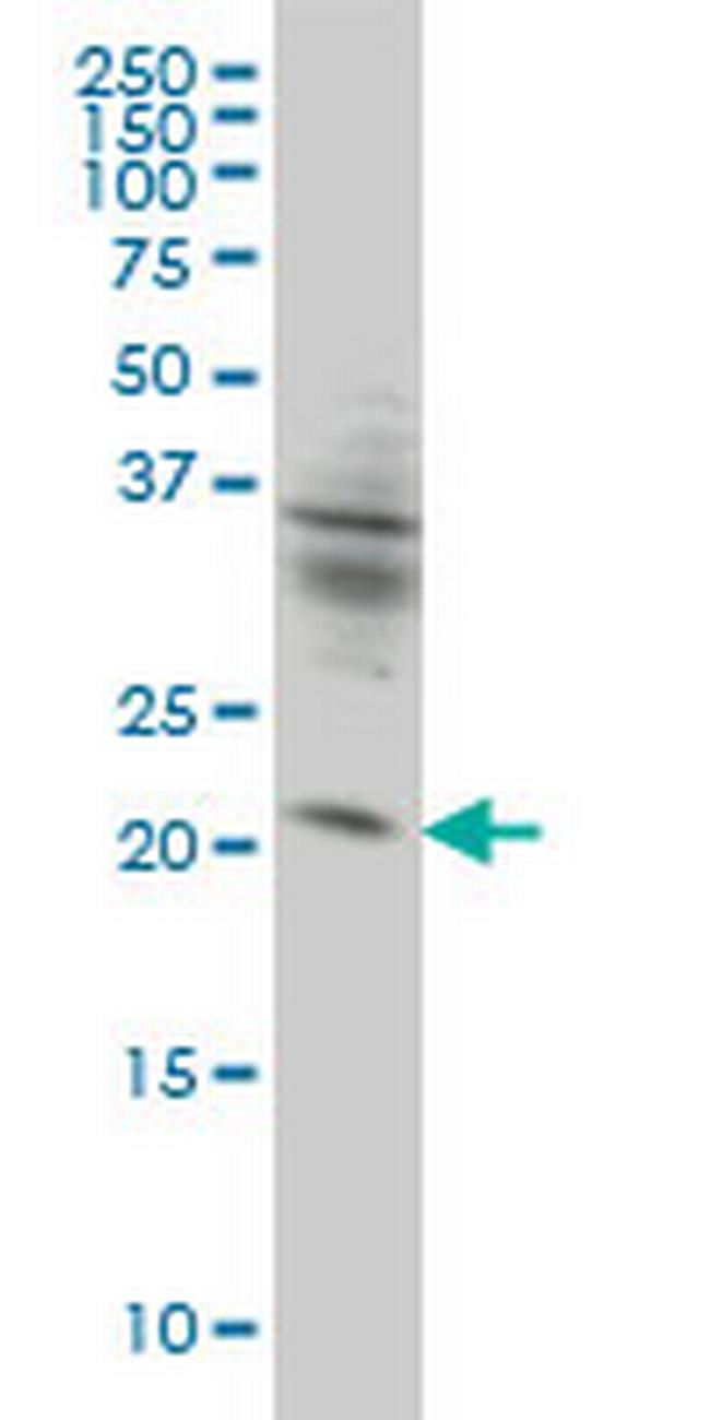 KIF26A Antibody in Western Blot (WB)