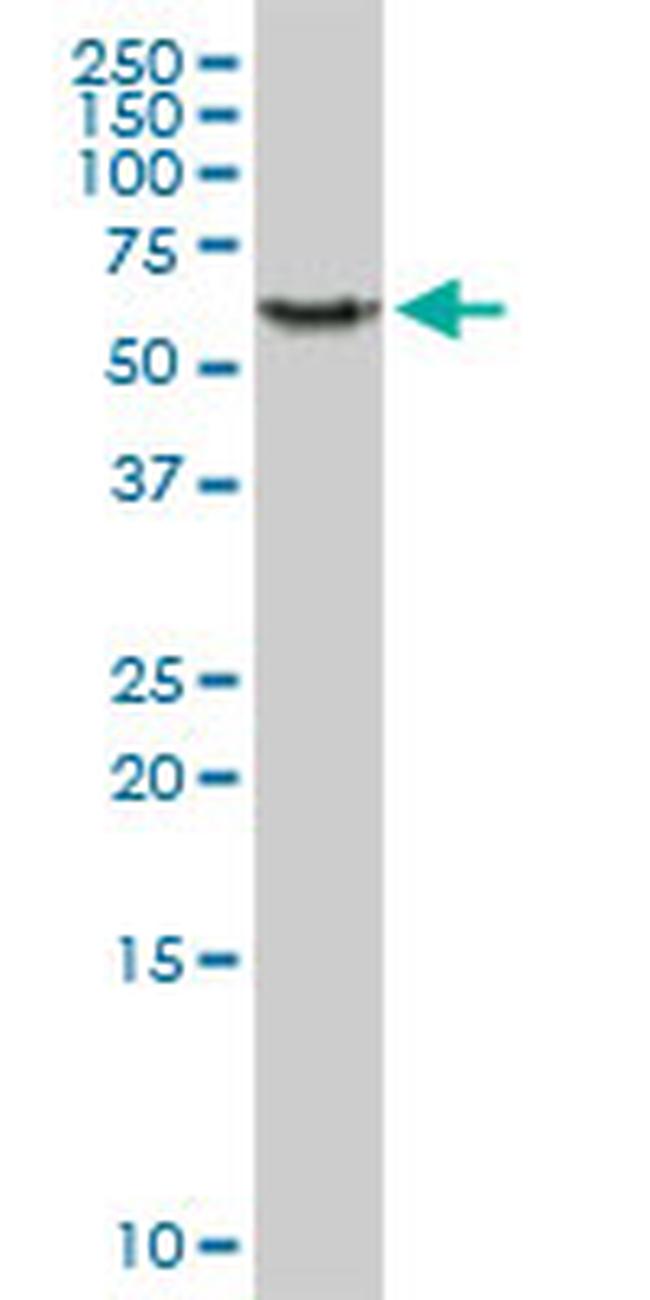 PHGDH Antibody in Western Blot (WB)