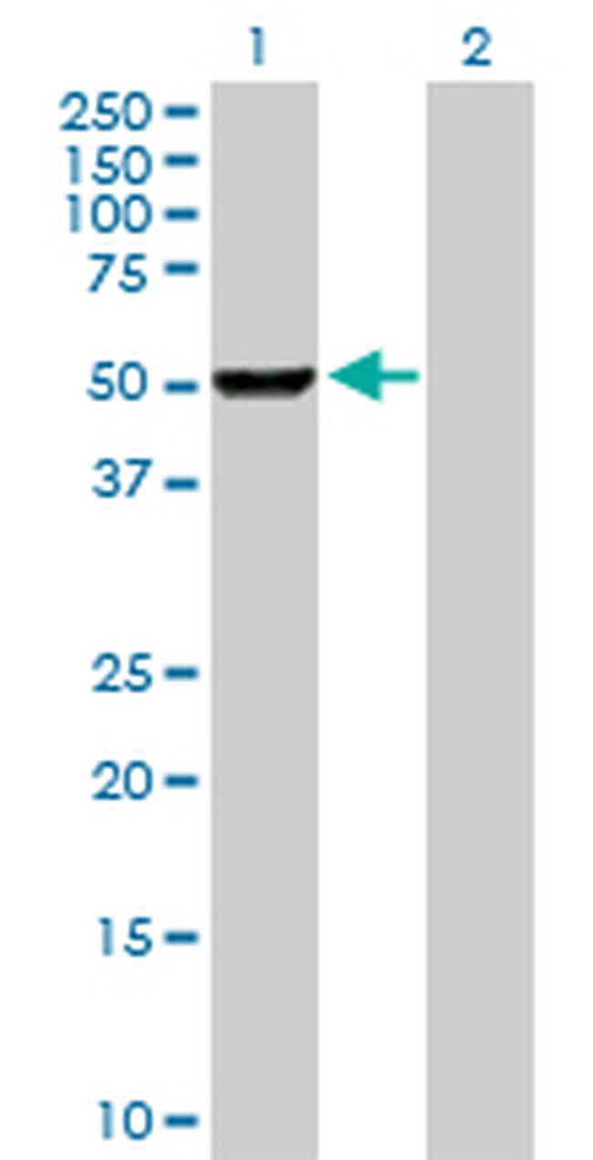 PHGDH Antibody in Western Blot (WB)