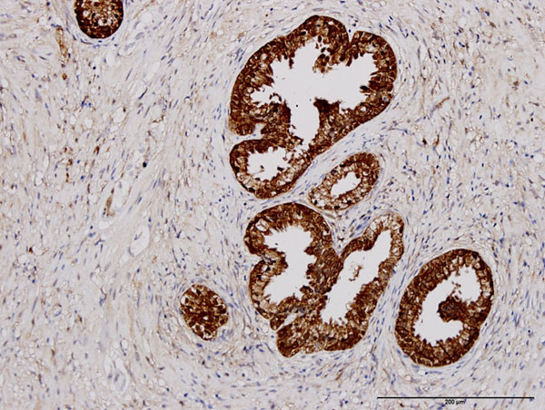 PHGDH Antibody in Immunohistochemistry (Paraffin) (IHC (P))