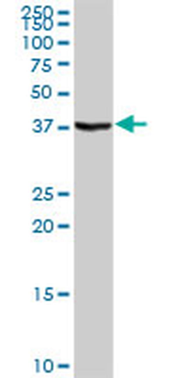 STAP1 Antibody in Western Blot (WB)