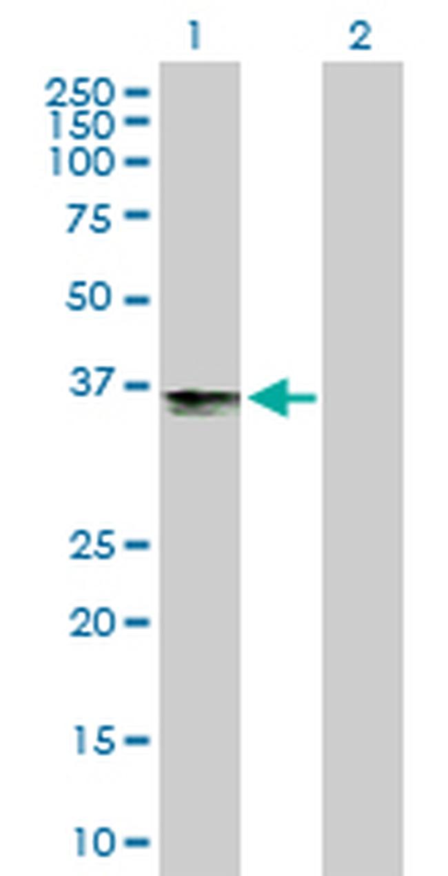 B3GAT3 Antibody in Western Blot (WB)