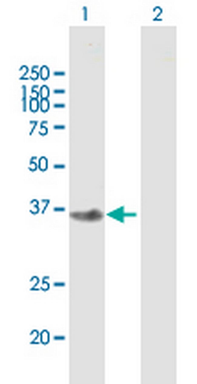 FBXO2 Antibody in Western Blot (WB)