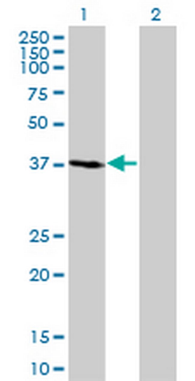 FBXO2 Antibody in Western Blot (WB)