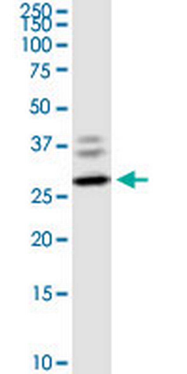 CLEC4E Antibody in Western Blot (WB)