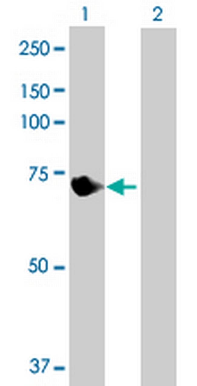 VPS33B Antibody in Western Blot (WB)