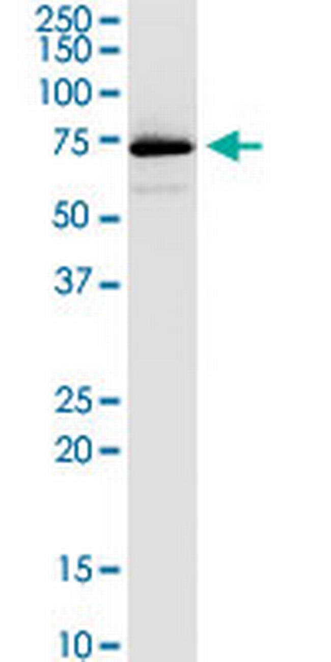 VPS33B Antibody in Western Blot (WB)