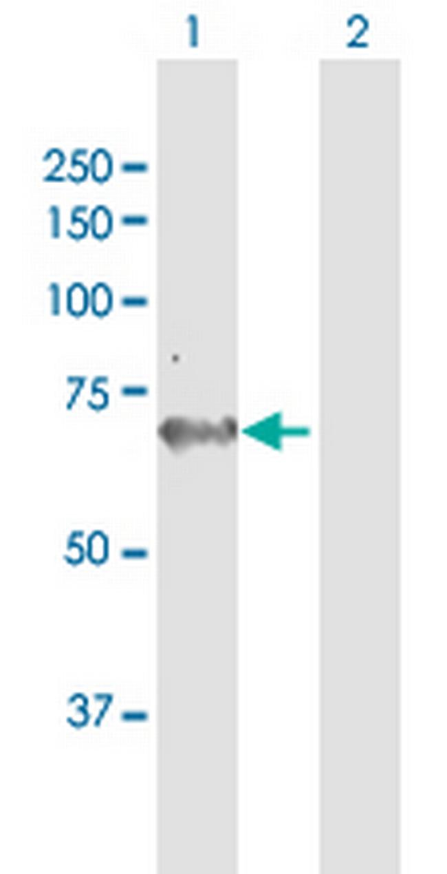 AK5 Antibody in Western Blot (WB)