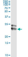 FGF21 Antibody in Immunoprecipitation (IP)