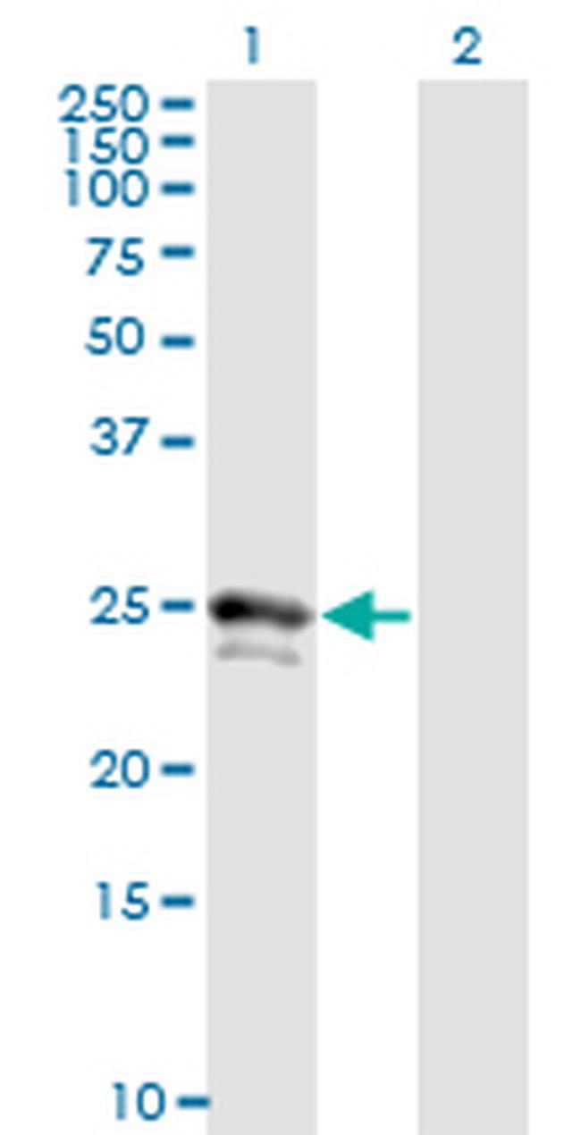 FGF21 Antibody in Western Blot (WB)