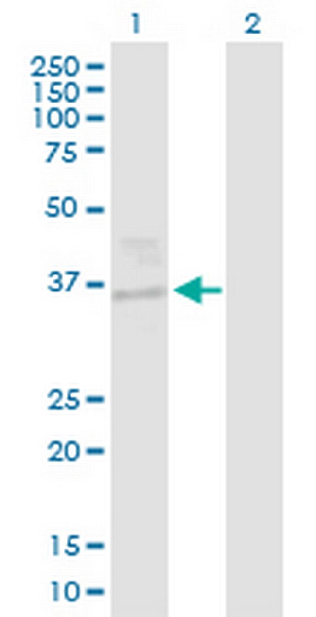 EHF Antibody in Western Blot (WB)