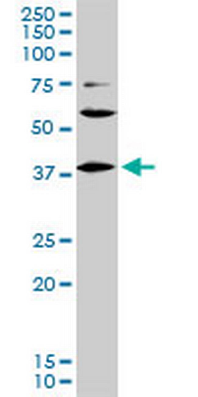 LHX6 Antibody in Western Blot (WB)