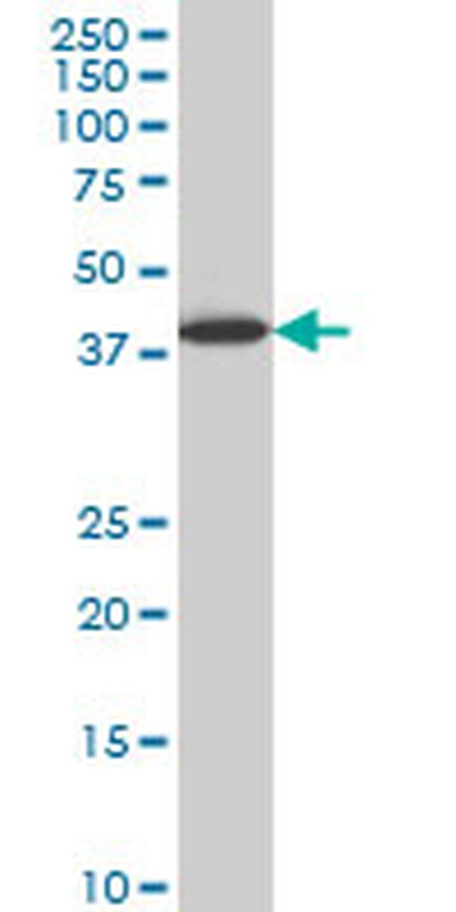 LHX6 Antibody in Western Blot (WB)