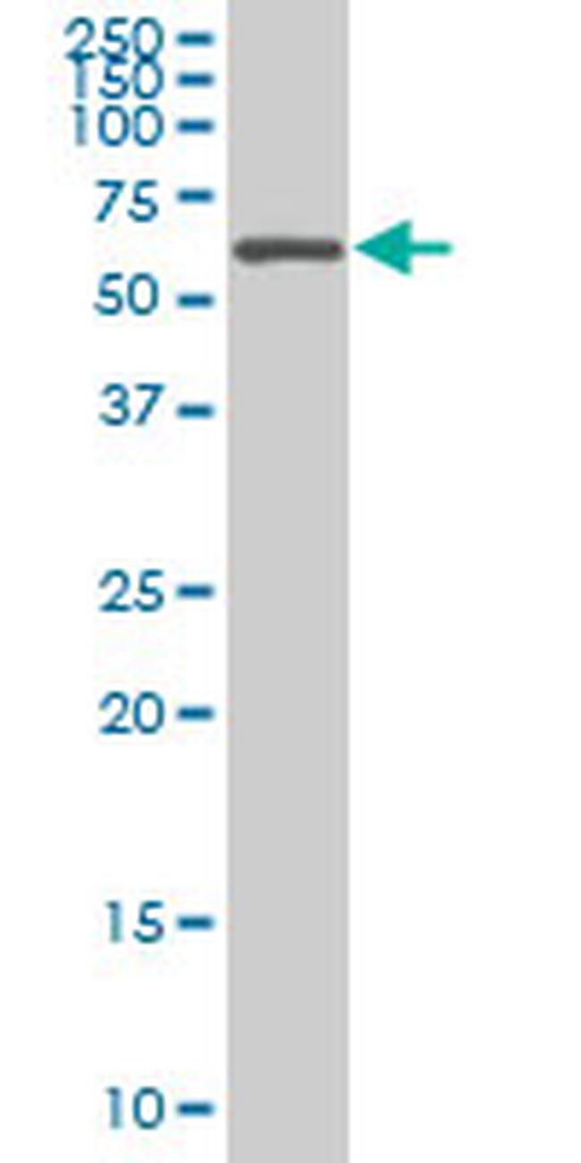 AATF Antibody in Western Blot (WB)