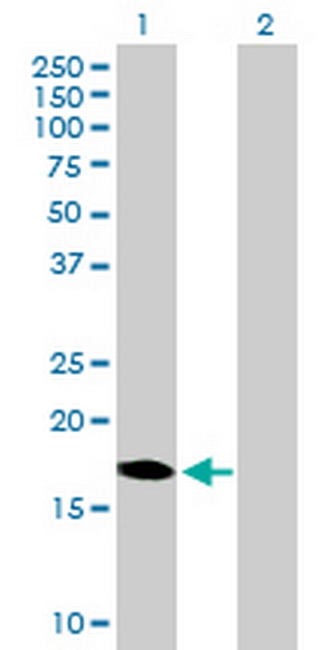 DUX3 Antibody in Western Blot (WB)