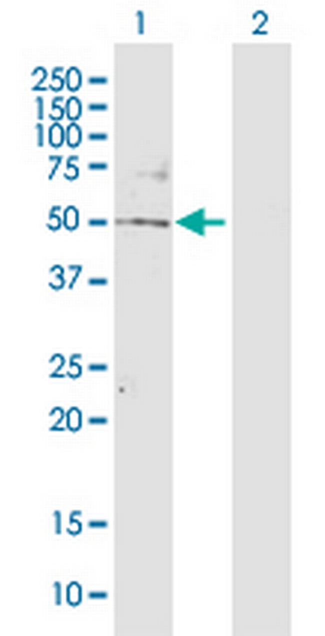 TBL2 Antibody in Western Blot (WB)