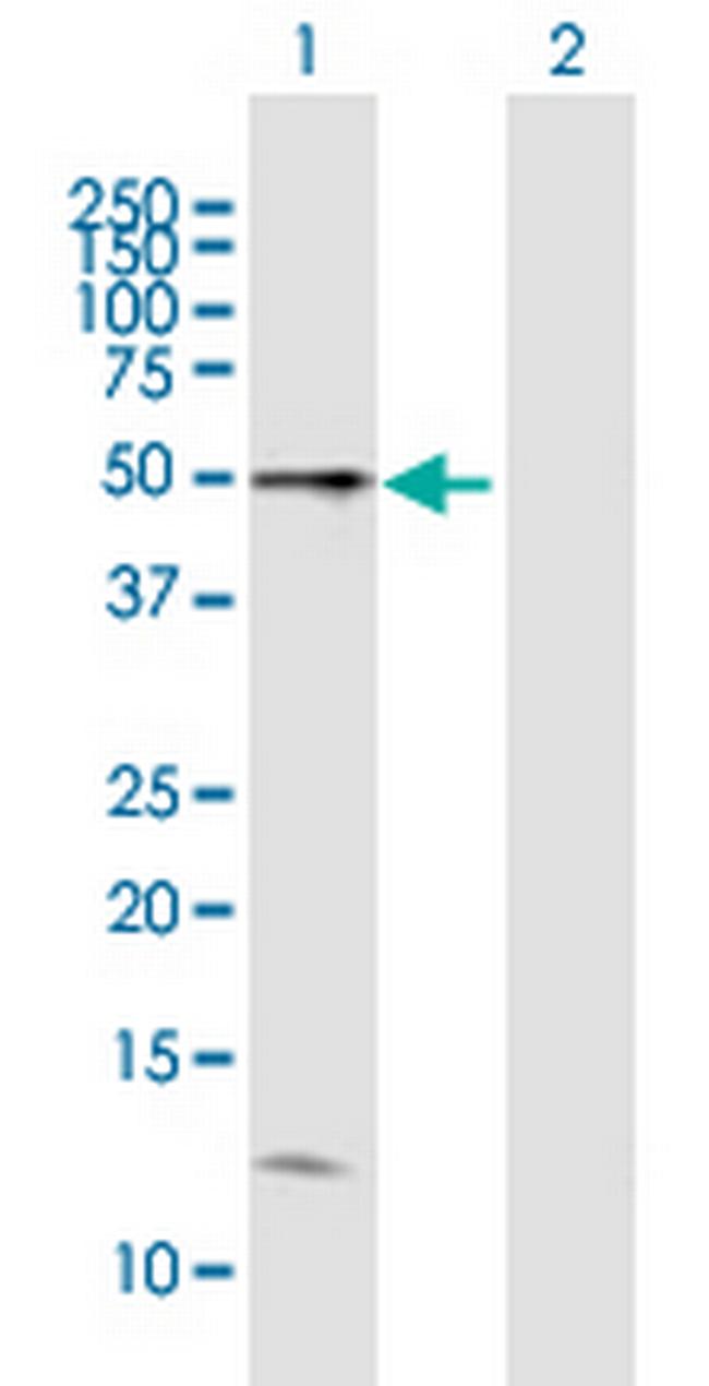 HAVCR1 Antibody in Western Blot (WB)