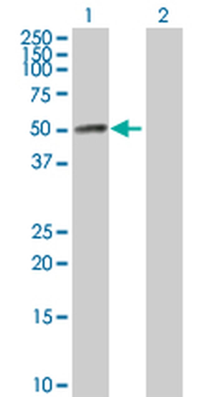 HAVCR1 Antibody in Western Blot (WB)