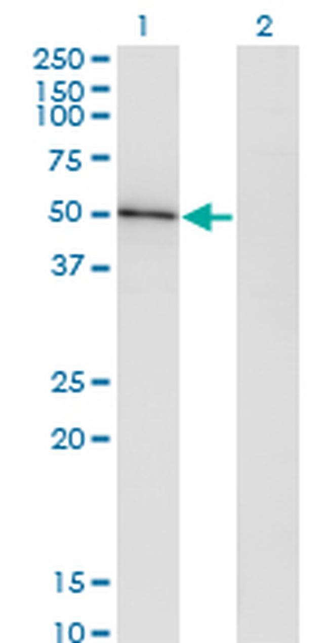 HAVCR1 Antibody in Western Blot (WB)