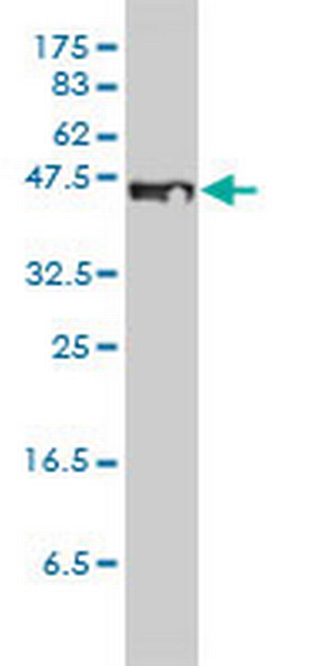 STEAP1 Antibody in Western Blot (WB)