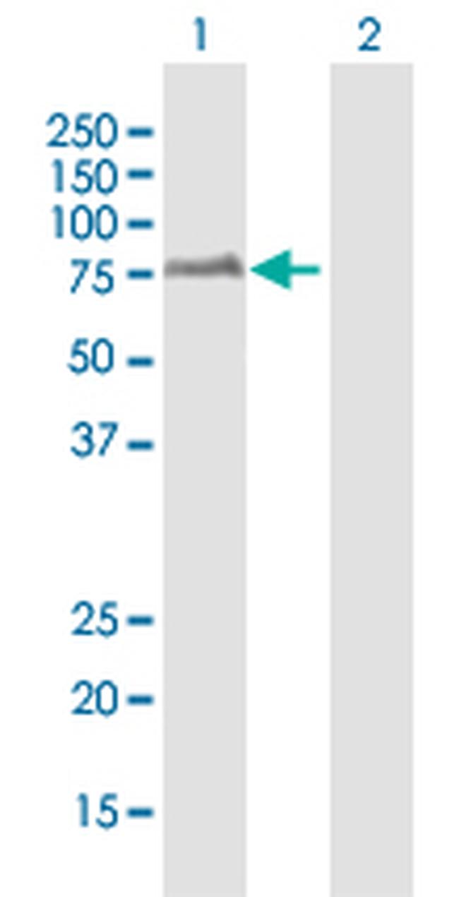 HBP1 Antibody in Western Blot (WB)