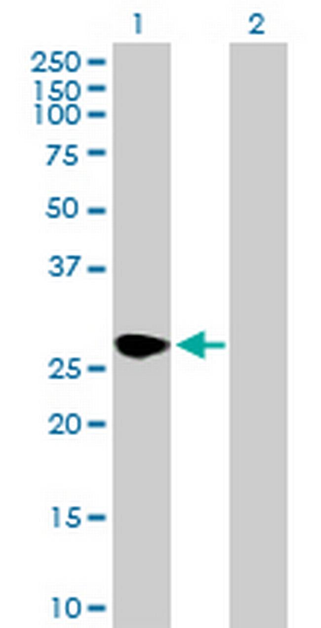 SEC22L2 Antibody in Western Blot (WB)