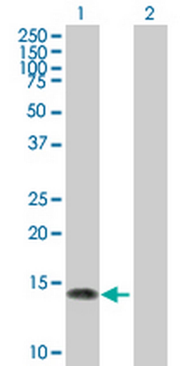 NGFRAP1 Antibody in Western Blot (WB)