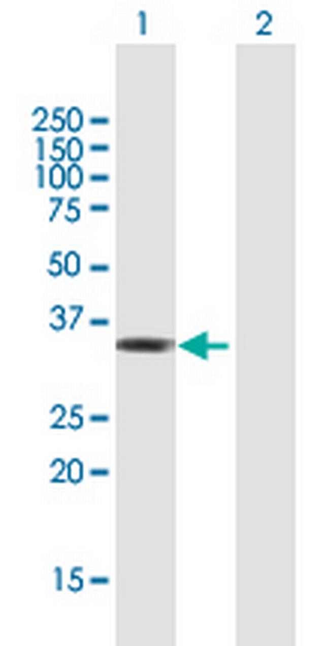 ZBTB32 Antibody in Western Blot (WB)