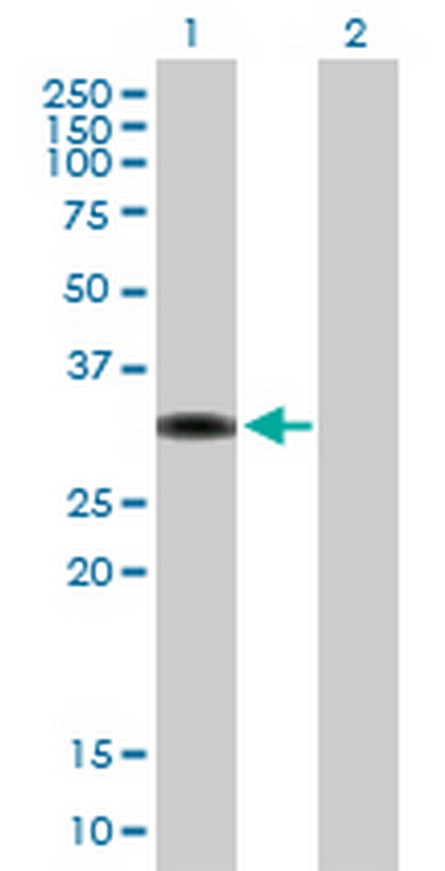 ZBTB32 Antibody in Western Blot (WB)