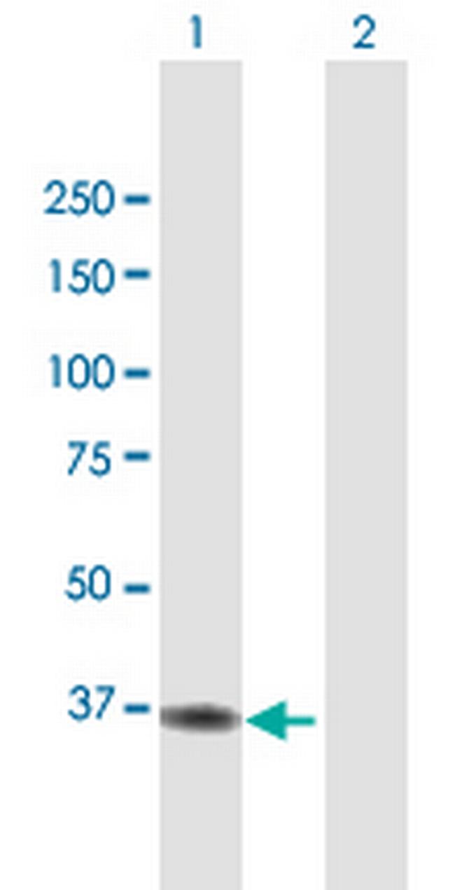 ACAD8 Antibody in Western Blot (WB)