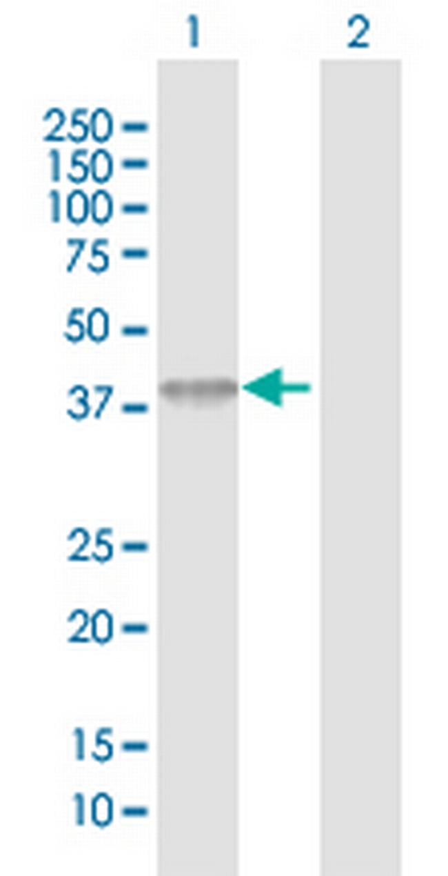 ACAD8 Antibody in Western Blot (WB)