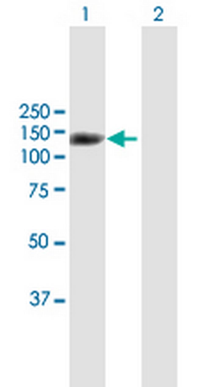 SND1 Antibody in Western Blot (WB)