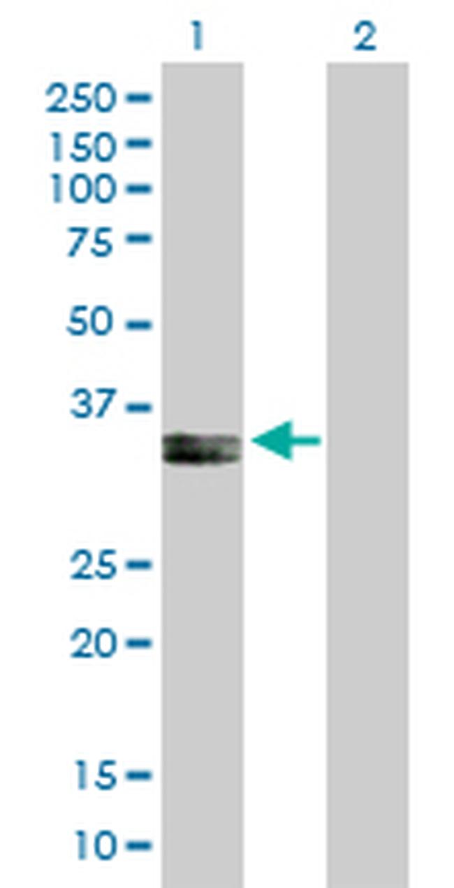 PPA2 Antibody in Western Blot (WB)